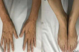Tưởng thay đổi tướng mạo, té ra mắc bệnh to đầu chi