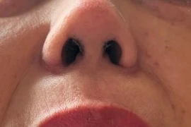 Chủ nhà dùng người giúp việc để thực hành nâng mũi sau ...3 ngày học! 