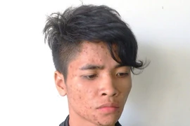 Bắt băng cướp bán dâm