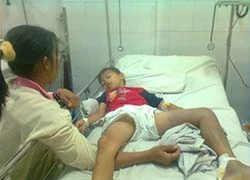  Cứu sống trẻ trèo cây hái mận bị rắn lục cắn