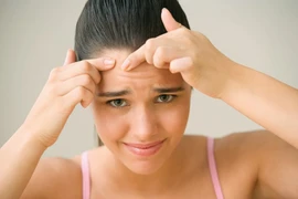 8 sai lầm trong điều trị mụn thường gặp