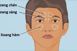 Cách nào biết trẻ bị viêm xoang? 