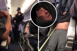 Toàn cảnh vụ bê bối United Airlines 'kéo lê hành khách'