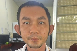 Giả mua rau 10.000 đồng để cướp dây chuyền 2 chỉ vàng