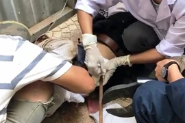 Người đàn ông bị thanh sắt rơi từ trên cao đâm xuyên bụng