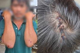 Nhóm trộm gà đánh chủ nhà bất tỉnh