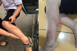 Cô giáo tát học sinh giờ kiểm tra bị đình chỉ 6 tháng