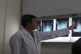 Bị ong đốt, 1 nữ sinh suýt tử vong