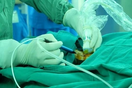 Phương pháp mới điều trị bướu cổ không cần phẫu thuật