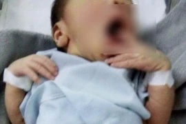 Bé mắc bệnh hiếm sinh ra không phân biệt được giới tính