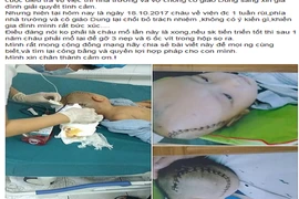 Bé 3 tuổi bị chấn thương sọ não ở trường mầm non