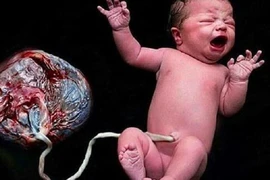 Hàng loạt bác sĩ lên án mạnh mẽ “sinh thuận tự nhiên“