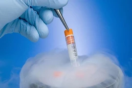 Chạy đua 'cứu' tinh trùng của người đã chết