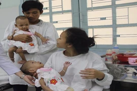Hơn 400 ngày nằm viện cặp đôi dính liền sắp được về nhà