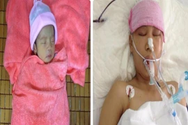 Thai phụ hôn mê, BS cố nuôi em bé trong bụng lớn lên