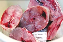 Cô gái tổn thương phổi nặng, suýt chết sau khi ăn cá ngừ
