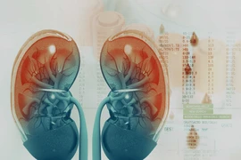 Những điều cần biết về suy thận và cách phòng ngừa