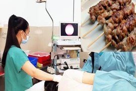 Ăn thịt nướng nuốt luôn xiên que phải vào viện cấp cứu