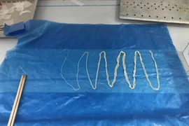Sán heo dài 2m sống trong ruột người đàn ông 10 năm