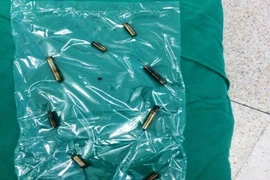Nuốt tám thanh nam châm, bé bốn tuổi thủng ruột nhiều nơi
