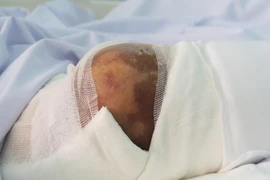 Uống thuốc truyền miệng, bệnh nhân tiểu đường mất mạng
