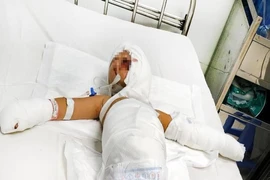 Bé trai bị bỏng nặng sau vụ ném bom xăng trả thù của người lớn