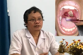 Bác sĩ Trương Hữu Khanh: Đừng cố tìm nguồn lây bạch hầu