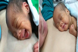 Sức sống mãnh liệt của bé gái sinh ra chỉ nặng 700gr