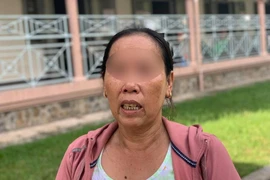 Bé 3 tuổi bị mẹ đánh chấn thương sọ não: Bà ngoại xin tha thứ