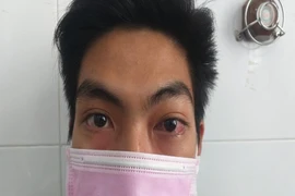21 tuổi đi khám mắt không ngờ phát hiện bệnh cực nguy hiểm