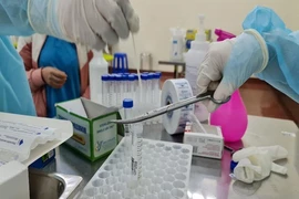 Hơn 1.000 người ở BV Mắt TP.HCM xét nghiệm khẩn COVID-19