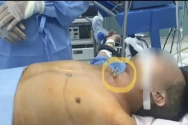 Cứu người đàn ông tự dùng kéo đâm vào cổ