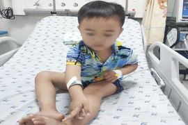Cậu bé 4 tuổi bị rắn cắn khi đang thả diều