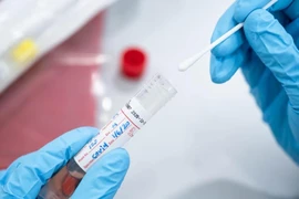 TP.HCM thay đổi cách thức lấy mẫu xét nghiệm COVID-19