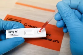 Bộ Y tế yêu cầu không tự xét nghiệm kháng thể COVID-19 sau tiêm vaccine