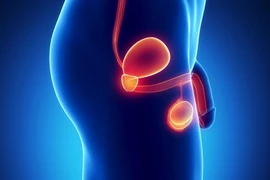 Triệt sản nam có làm mất chức năng sinh lý của quý ông? 