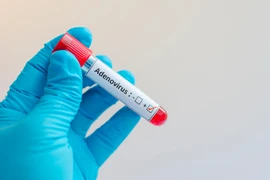 Chuyên gia cảnh báo trẻ mắc Adenovirus, cần bình tĩnh