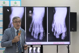 Chuyên gia Pháp đánh giá cao mô hình điều trị của Viện Gút