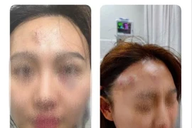 Khởi tố người hành hung bạn gái trong quán cà phê ở Bình Chánh