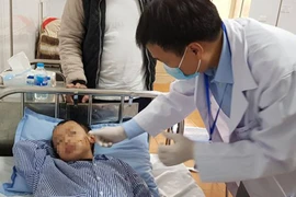 Hà Nội: Bé trai 8 tuổi bị chó béc giê cắn rách mặt và môi