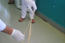 Lấy con sán xơ mít dài 8 m ra khỏi cơ thể bệnh nhân