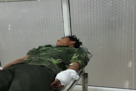 Công an bắt 5 người liên quan vụ chém kiểm lâm trọng thương