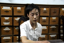quẹt xe, rút dao đâm hai người trọng thương
