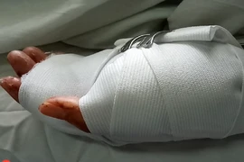 Cô gái bị nhóm thanh niên truy sát trong quán game bắn cá