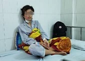Người đàn ông cắt tai, hành hạ vợ cũ dã man