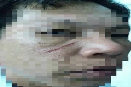 Xưng phóng viên, đánh công an xã