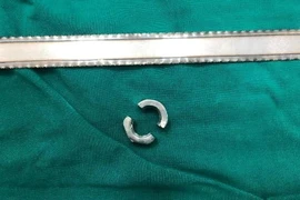 Vào viện cấp cứu vì đeo khoen kim loại cho dương vật