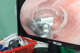 Lấy viên thuốc còn nguyên vỏ trong thực quản bệnh nhân COVID-19