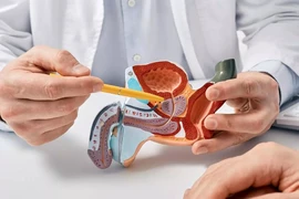 Làm thế nào để bạn có thể giảm nguy cơ mắc ung thư tuyến tiền liệt?