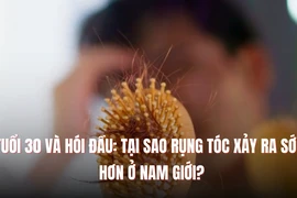 Tuổi 30 và hói đầu: Tại sao rụng tóc xảy ra sớm hơn ở nam giới?